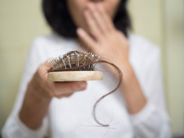 头发容易掉吃什么食补 你知道这些这些食物吗