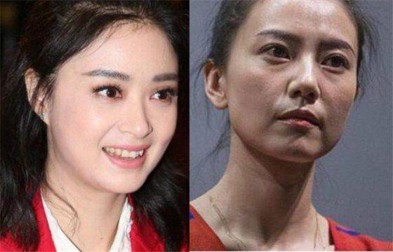 1516761669843508.jpg 曾经的甜心教主王心凌脸垮成这样了 真替这5位女星捏把汗啊