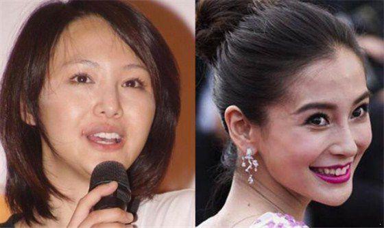 1516761669442883.jpg 曾经的甜心教主王心凌脸垮成这样了 真替这5位女星捏把汗啊
