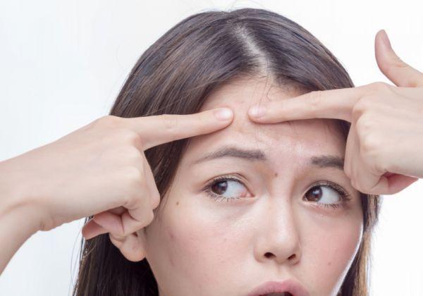 粉刺是怎么形成的