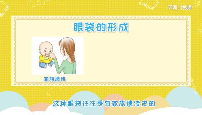 眼袋是怎么形成的 眼袋是什么