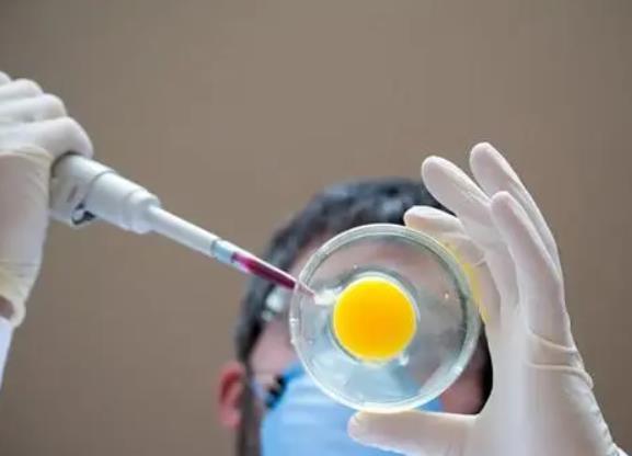 做完人工授精之后，有什么应该注意的？