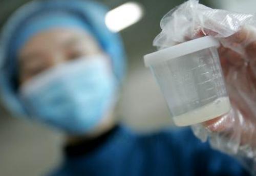在惠州中心医院做一次精子检查需要多少钱?