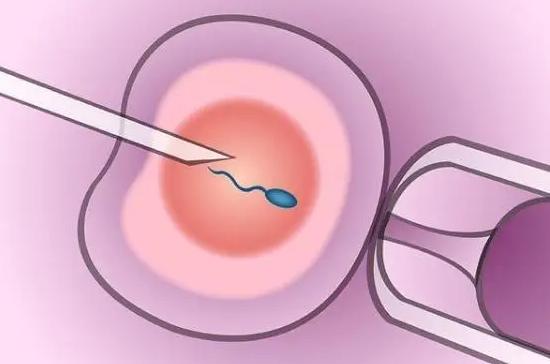 35岁以上做试管婴儿有没有什么优惠？