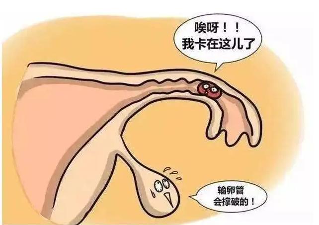 流产后患有盆腔附件炎，能继续移植吗？