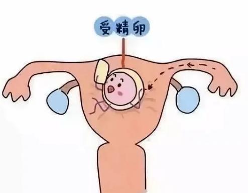 美国试管婴儿可以帮助免疫性不孕的女性生育吗？