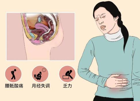 女性患有轻微的盆腔炎之后同房会伤害身体吗？