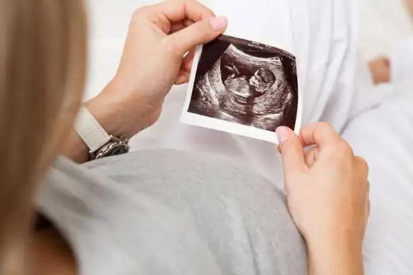 无创dna的结果要怎么在手机上查询？具体步骤是什么？