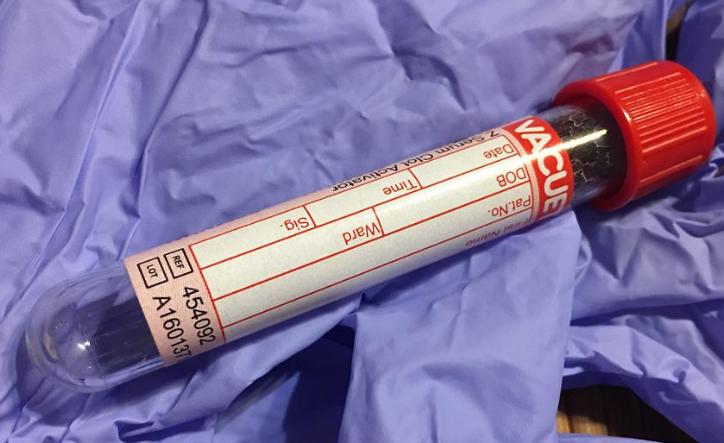 男性患有弱精症，应该选择二代试管还是三代试管？