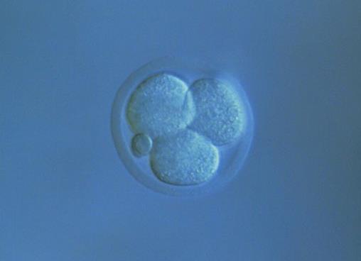 试管婴儿助孕过程中产生的费用可以报销吗？