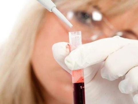 性激素六项检查什么时候做检查结果最准确？