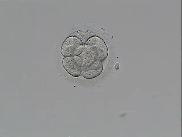 5天的4bc和3bc囊胚移植哪个更好?