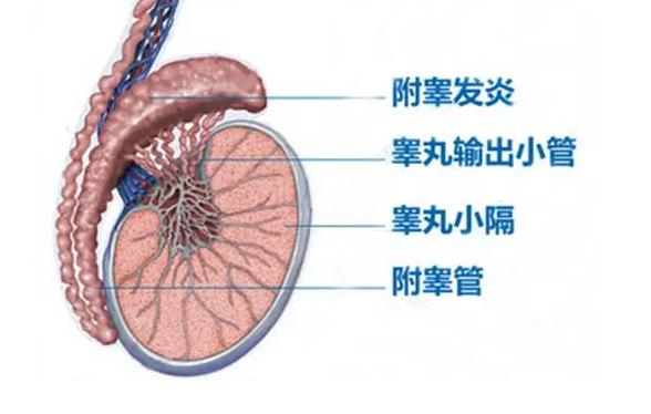 沈阳附睾炎做试管婴儿的费用预算多少才够?