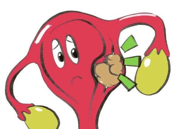 轻微子宫肌瘤患者在武汉做试管婴儿手术有哪些医院可以推荐？