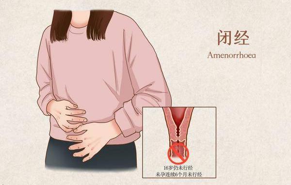 原发性闭经患者调理后再进行试管婴儿能否提高胚胎着床率？