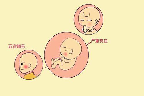 做试管婴儿会出现畸形吗？如何避免？