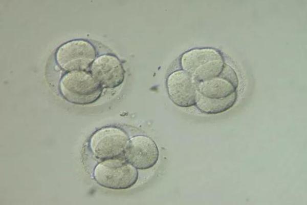 在乌克兰做试管婴儿的费用是多少？比其他国家实惠吗？