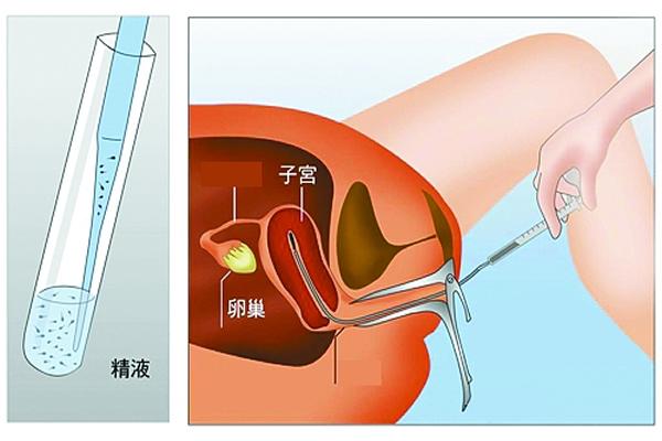 在福州做人工授精需要花费多少钱？做三代试管呢？