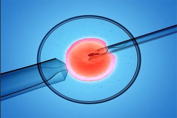 试管婴儿移植前必须做输卵管造影吗？