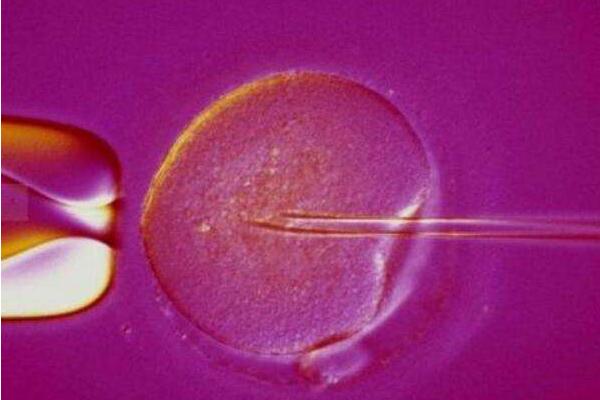 在美国试管婴儿需要花费多少钱？还有其他费用吗？