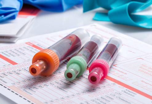 AMH值低于多少做试管婴儿比较合适？