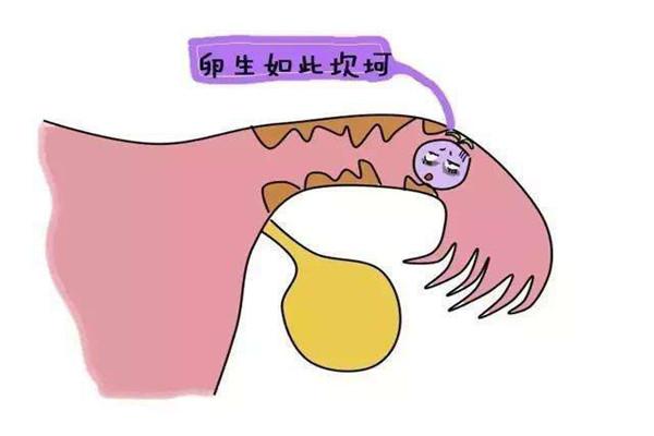 单侧输卵管堵塞患者做供卵试管婴儿大概要多少钱?期间需要注意什么?