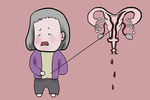 患有子宫肌瘤在深圳做试管婴儿的费用大概是多少？