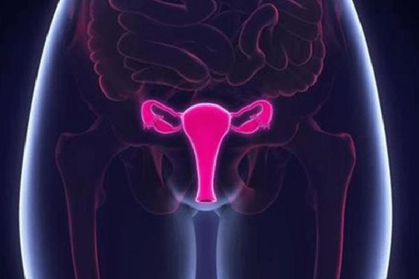 卵巢囊肿患者在美国做三代试管婴儿促排用什么方案？