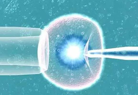 2023年在绍兴进行一次试管婴儿手术需要多少费用?