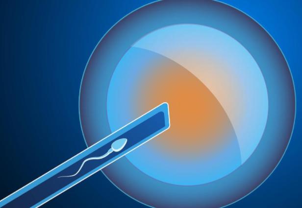 试管移植后12天出现明显姨妈感，是否表示即将来例假？