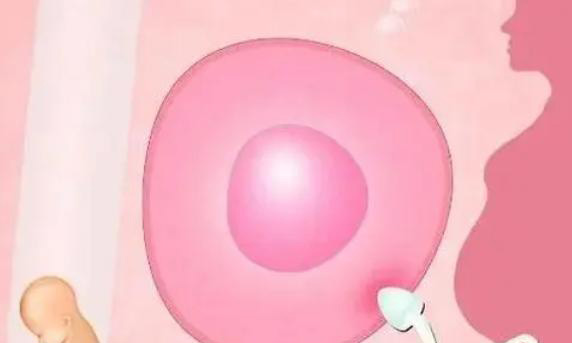 自己体内膜异位症在钦州市妇幼保健院做三代试管成功率是多少？