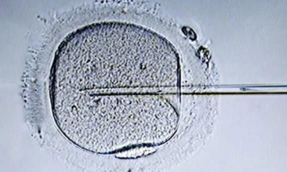 x细胞碎片率高可以做三代试管婴儿生孩子吗?