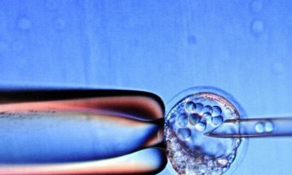 试管一次取多少和卵?取出了40个正常吗?