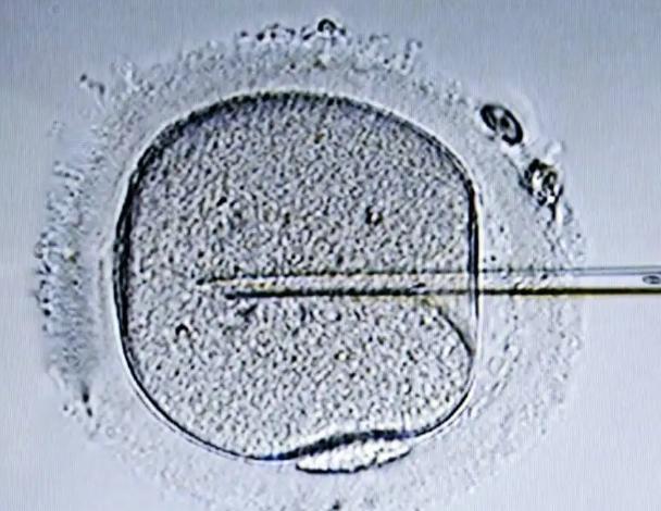 三级8细胞养囊的成功率，一文带你了解