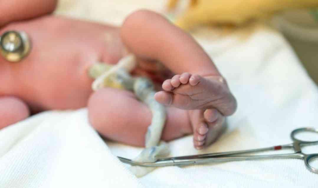 脐带剪断，富强和新生儿谁痛？