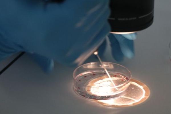 2023格鲁吉亚自己辅助生殖费用预估，是否需要一次付清还得看个人选择