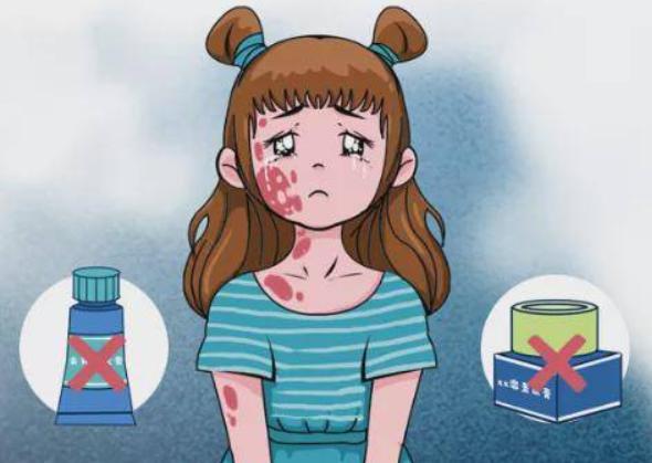 银屑病为什么反反复复复正常吗,如何治疗比较有效