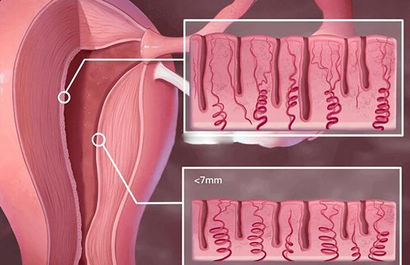 为什么取卵后第三天才能移植,取卵后三天移植的条件