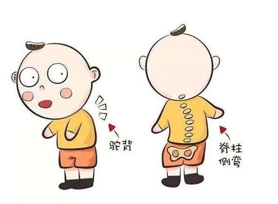 软骨发育不全怎么办,宝宝软骨发育不良可治愈吗