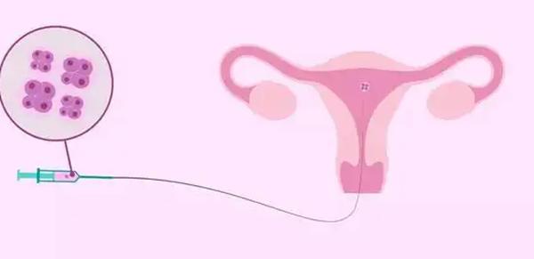 试管移植后胸痛预示着什么？是着床的信号吗？