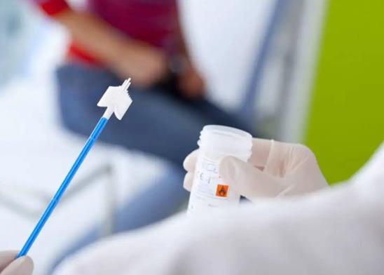 尿检就能确定是否怀孕了吗