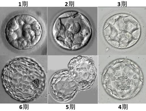 医生建议全部养囊是私心还是为你好，全部养囊的原因在这