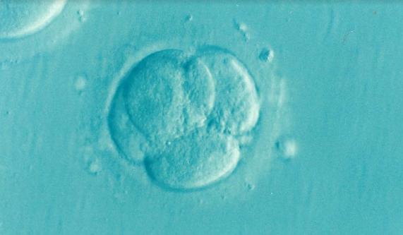 国内医院做三代试管婴儿要满足3个条件，国外却不需要