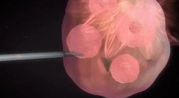 移植后如何促进HCG翻倍？这4个因素要注意