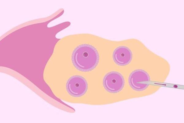 为什么泰国试管婴儿这么受欢迎？有什么过人之处？