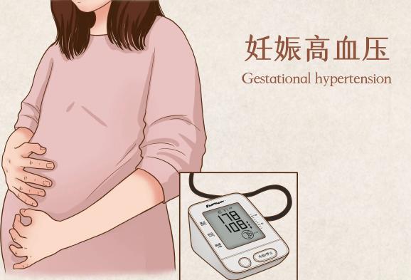 妊娠高血压对孕妇健康危害大，及时发现才能尽早进行治疗