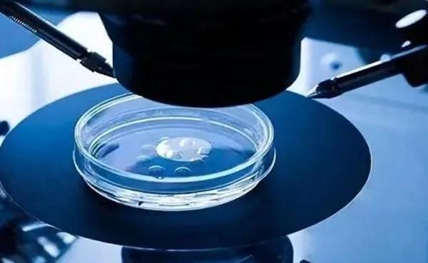 试管遗传检查，让你的下一代远离遗传困扰