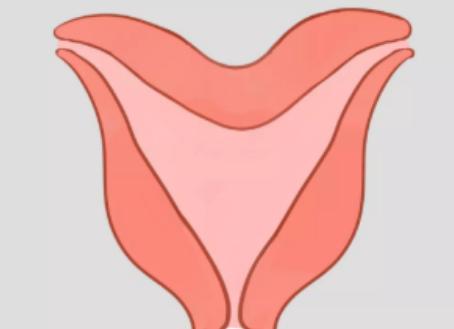 试管技术：双角子宫患者事项生育梦想的主要方式