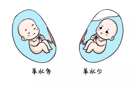 羊水过少对孕晚期女性生产有危害，羊水低于多少不能顺产各位女性一定要了解