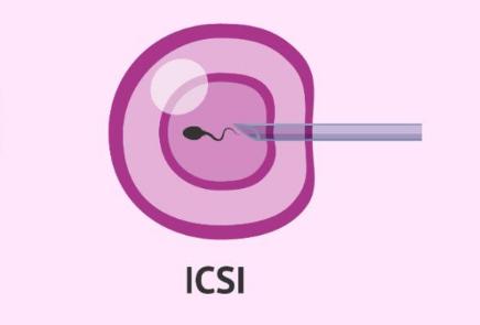 试管婴儿改良方案是什么，了解的女性朋友并不是很多